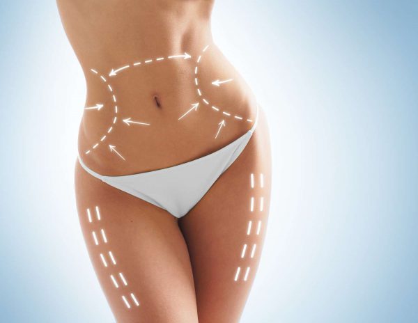 Liposuction cannot tight your skin